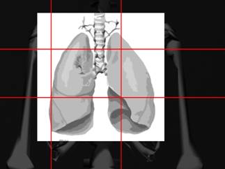 Superposicin de dibujo de los pulmones sobre el esqueleto.
