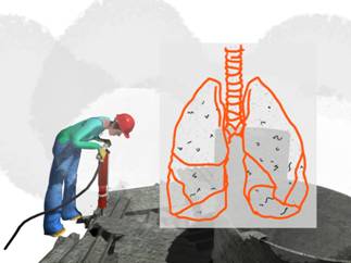 Superposicin de esquema de los pulmones sobre la imagen anterior.