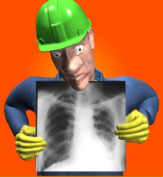 Trabajador con radiografa de los pulmones.