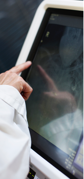 Pantalla amb una radiografia de la capsa toràcica